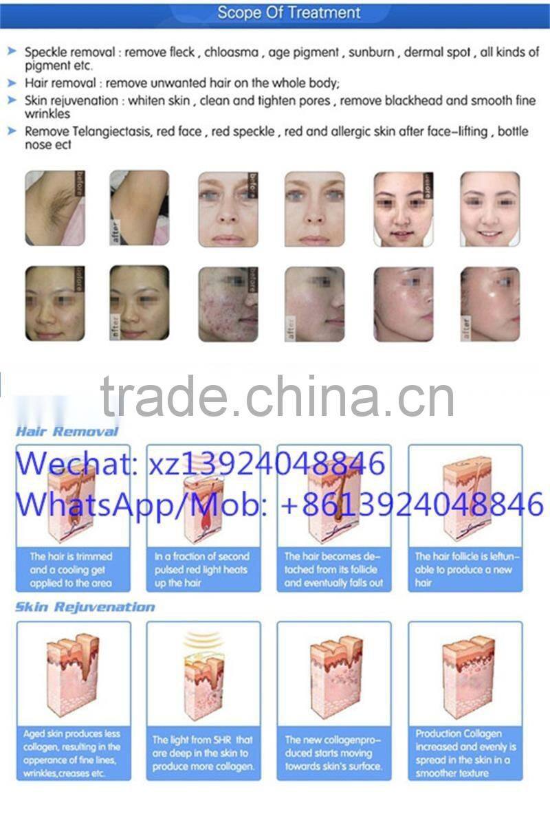Skin care products acne scar removal & ipl shr opt hair removal beauty equipment