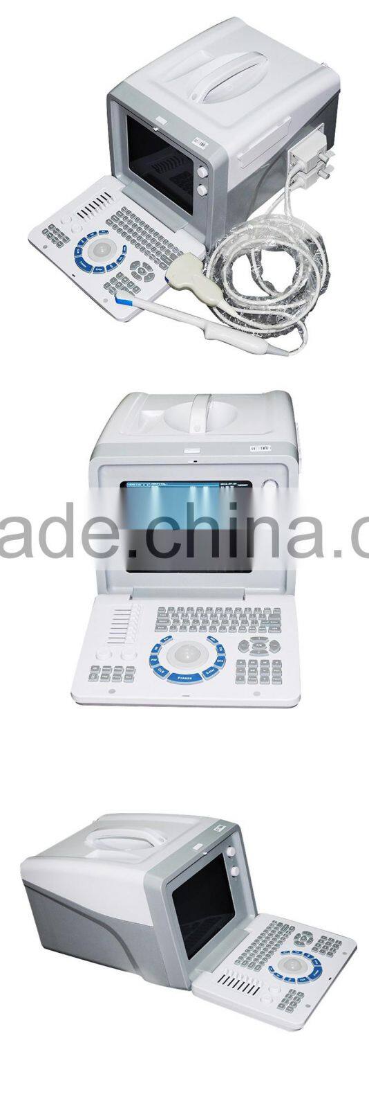 High Quality Ultrasound Machine Medical equipment ultrasound machine portable