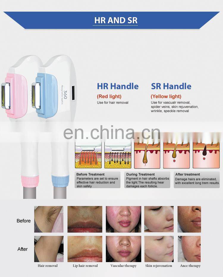 360 magneto-optical beauty equipment IPL epilator hair removal laser
