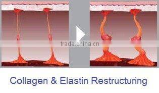 rf + cavitation slimming machine