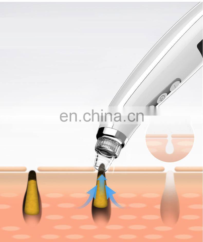 Popular Facial Beauty Blackhead Remover Tool Kit Stock Blackhead Removal with Advanced Vacuum Technology
