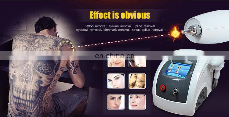 Multifunctional skin whitening eyebrow washing device Nd: Yag laser machine