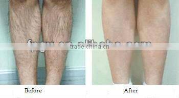 Professional E-light Beauty Machine For Skin Care Hair Removal