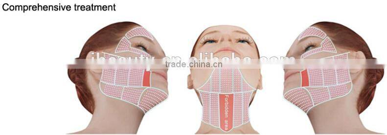 2015 Most Popular Lift Eyes&Brows Remove Crows Feet & Pouches High Intensity Focused Ultrasound Hifu