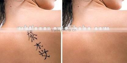 1064 nm 532nm 1032nm 1200W q-switch nd:yag laser / laser machine prices eyebrow washing laser laser tattoo removal