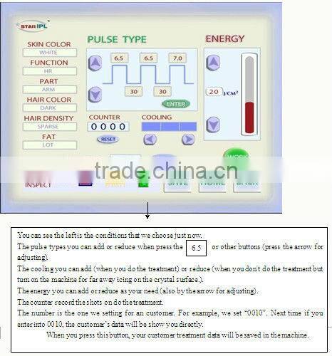 High-tech hair removal,anti wrinkle,multi-functional beauty machine,IPL+Nd Yag laser in one