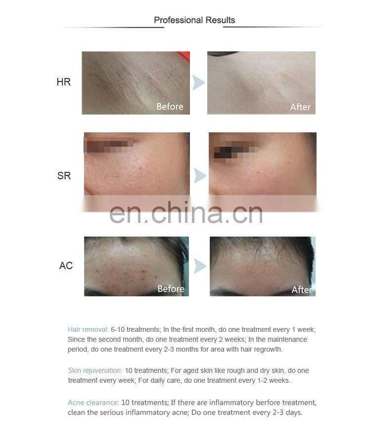 World popular small IPL beauty machine mini portable ipl body hair removal depilatory