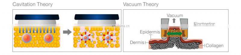 9 In 1 Multifunction Beauty Machine/ Lipolaser/ Cavitation/ Vacuum/ Rf Slimming Beauty Machine