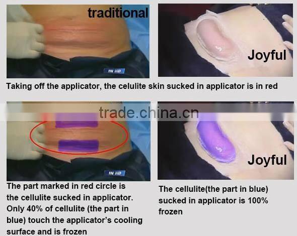 home body beauty vacuum suction machine