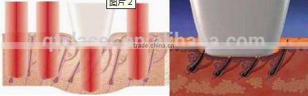 hair removal spray/alexandrite laser hair removal machine