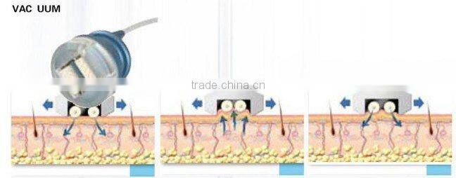 latest bipolar and tripolar radio frequency cavitation slimming beauty Fat Dissolving equipment