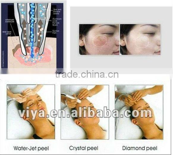 VY-300 Diamond peel machine crystal microdermabrasion machine for sale