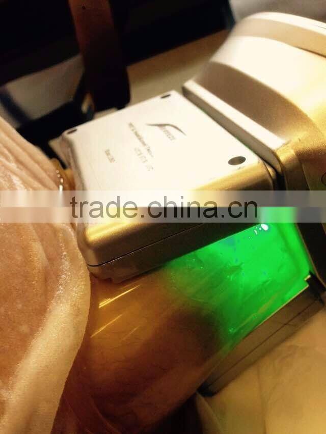 home use Cryolipolysis fat freezeing cold therapy Cellulite cryo lipolysis vacuum slimming machine