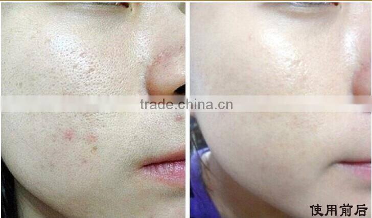 24k gold leaf facial mask anti-aging control whitening moisturizing face mask