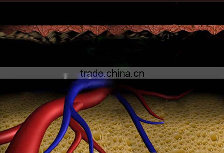 hair removal beauty 808nm soprano laser plastic epilator machine