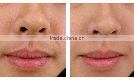 CE newest IPL RF hair removal China new beauty machine price 2013 salon spa or home use A006