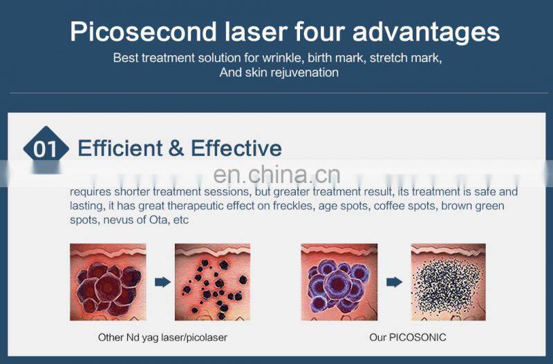 Best profession portable pico second laser eye brow tattoo malasma pigment removal machine