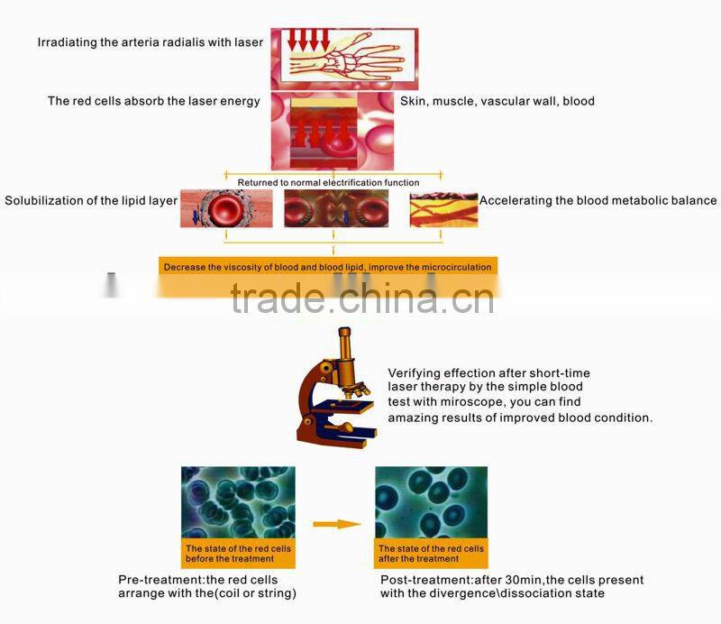 health care product HNC watch laser treatment instrument rehabilitation equipment