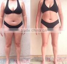 Fat loss machine laser liposuction weight loss beauty machine ultrasonic liposuction cavitation machine for sale