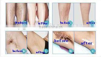 2015 professional Hot sale hair Removal IPL machine
