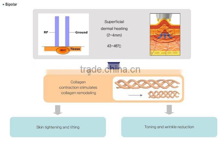 cheap price RF machine radio frequency for wrinkle removal