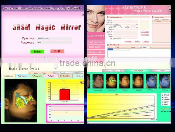 skin analyzer software /skin and hair testing machine /face skin test machine