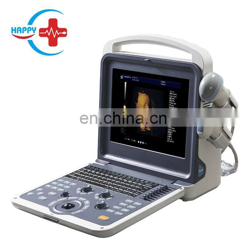 HC-A011 newest portable 4D color doppler ultrasound system
