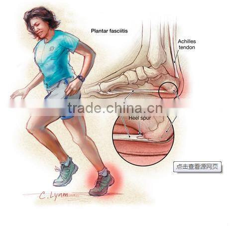 2015 hot selling foot patches,Healthcare foot patch for foot sickness