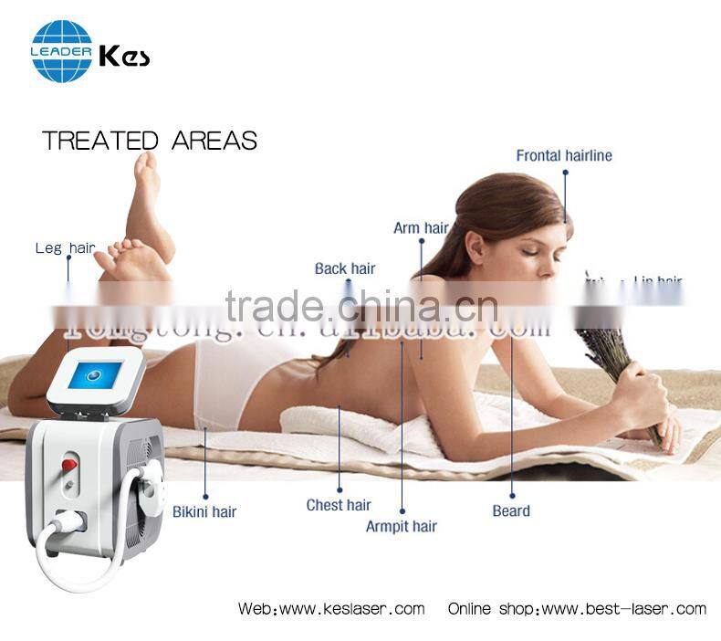 808nm diode hair removal laser personalization machine