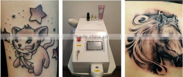 high quality nd yag laser / q-switched nd yag laser for tattoo removal machine
