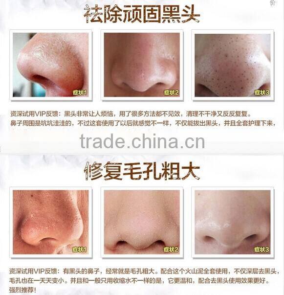 High Quality Deeply Blackhead Removal Nose Pore Strips