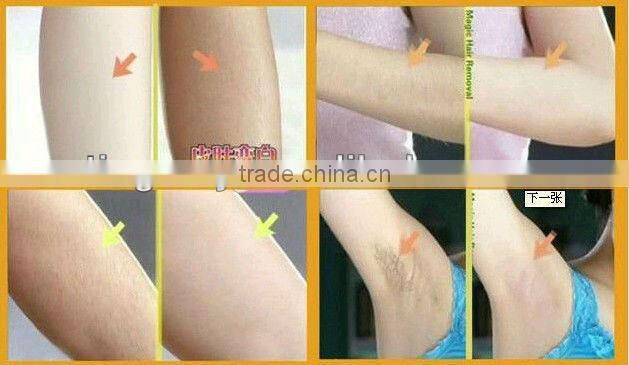 2013 best laser hair removal machine tm-j108