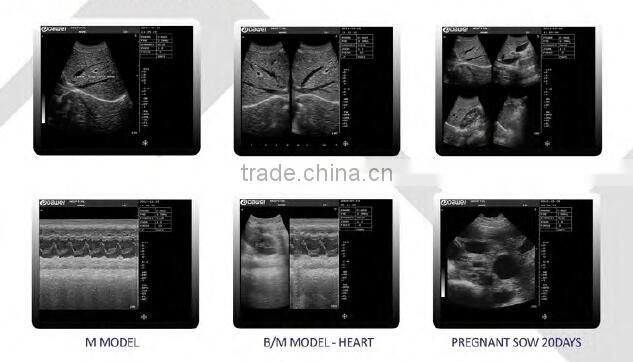 Full digital portable ultrasound scanner