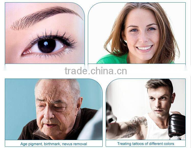 newest 1064nm & 532nm q switched lasers tattoo removal machine