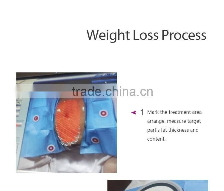 2016 ultrashape hifu body slimming machine / liposonic machine / ultrasonic ultrasound liposuction equipment for weight loss