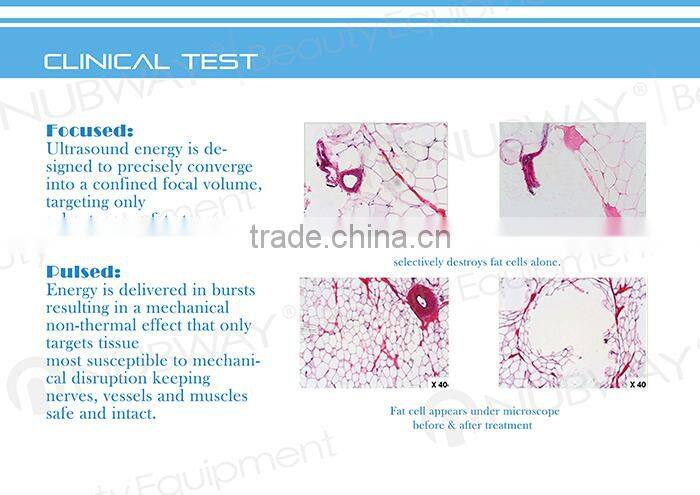 china newest effective ultrasound hifushape cavitation body slimming beauty machine price for sale