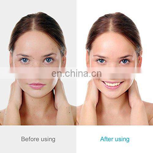 Laser Mole Removal Tool Dark Spot Remover Freckle Tattoo Wart Pen Machine Skin
