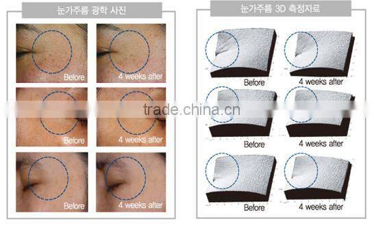 Sunscreen And Waterproof Vikos EGF BB Cream