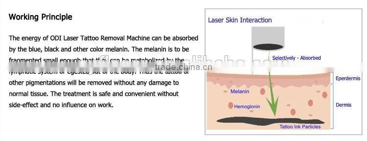 big sale laser tattoo removal machine active q switch nd yag laser tattoo removal pigment removal beauty equipment machine