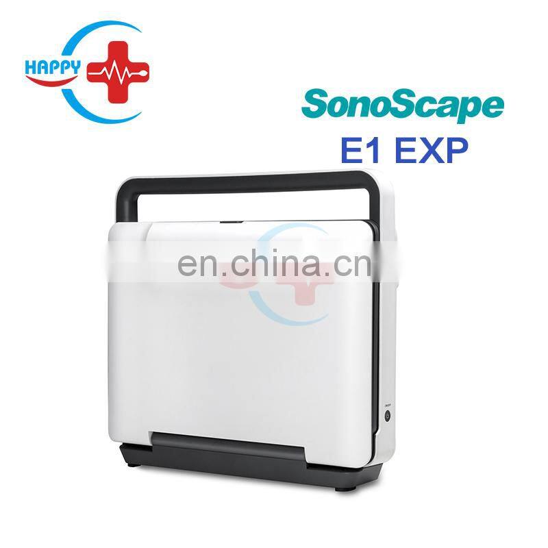 New advanced Sonoscape ultrasound e1 exp/Ultrasound color doppler/Portable ultrasound scanner
