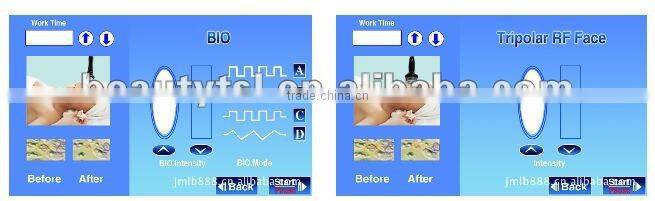 Hot Sale massager lymphatic drainage,lymphatic drainage device,rf vacuum lymphatic drainage