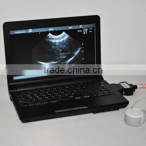 CE approved Laptop Ultrasound machine with Convex Linear Probe price 10 inch external 3D software optional