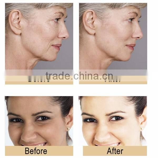 EYCO multifunction beauty device radio frequency machine for skin tightening radio frequency facial treatment rf facial machine