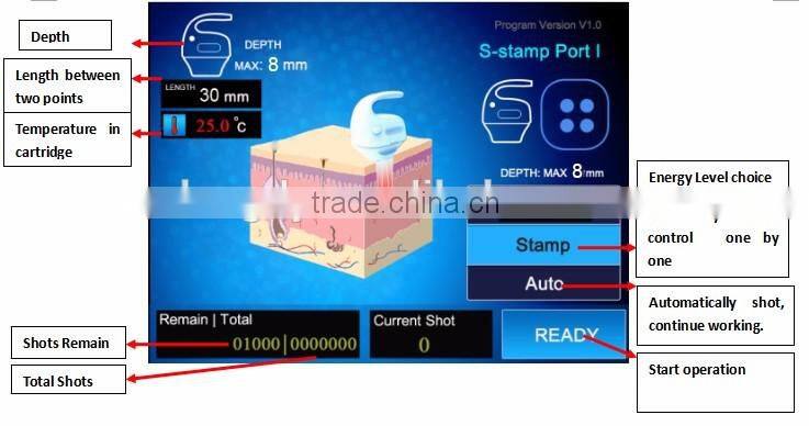 Effective stubborn fat removal HIFU slimming liposonix machine