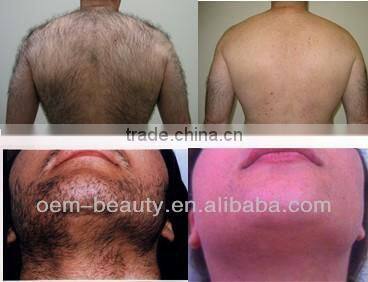 2014 super Cooling systern Nd Yag Laser Hair Removal / Long Pulse Laser Hair Remover MachinesP003