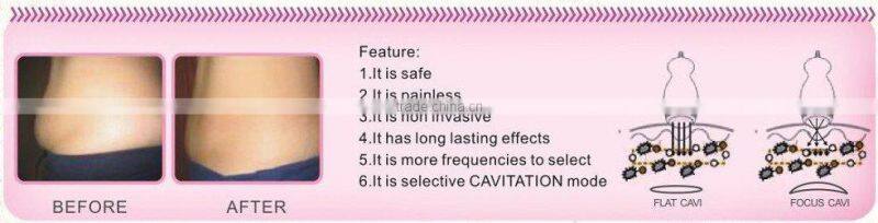 Ultrasound Slimming Machine