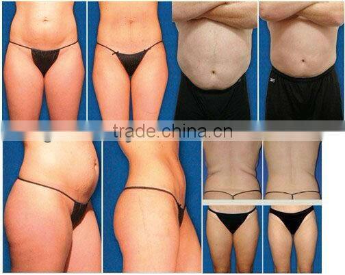 WL-20 ZERONA i lipo laser weight loss machine