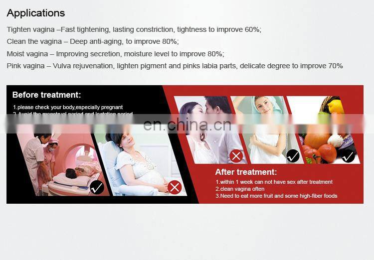 70W medical fractional co2 laser/co2 fractional laser/laser co2 fractional with CE