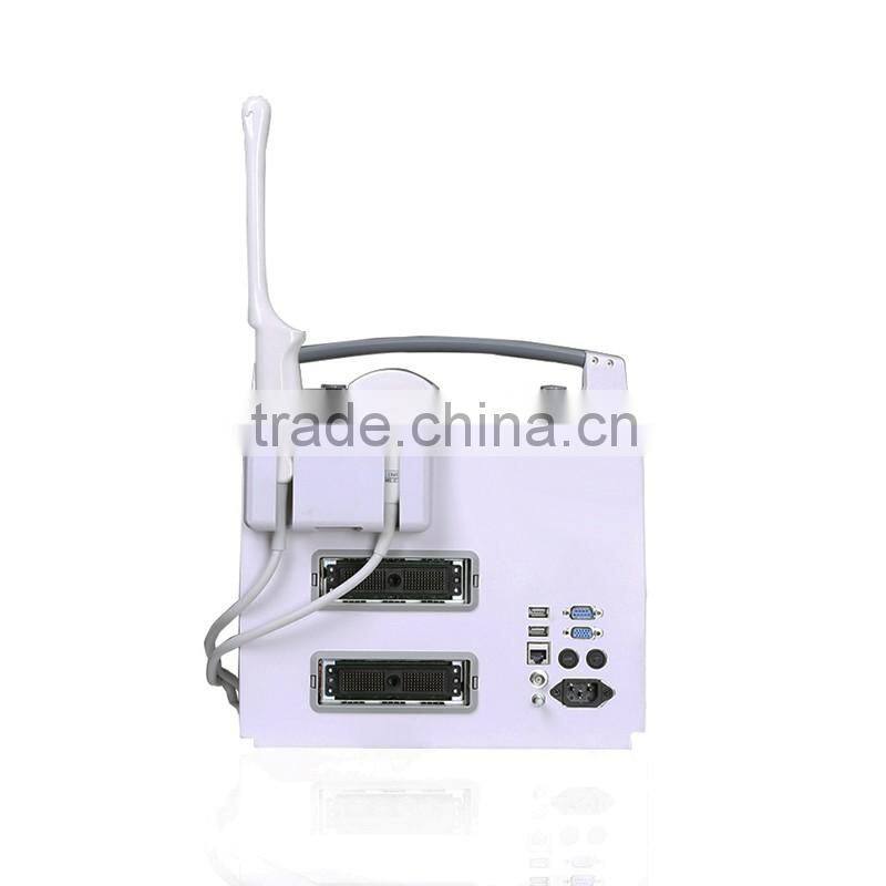 promotion price cheapest 3D laptop color doppler ultrasound/doppler ultrasound