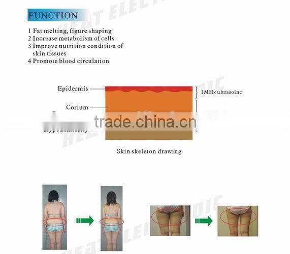 2015 vacuum cavitation RF laser slimming machine for cellulite